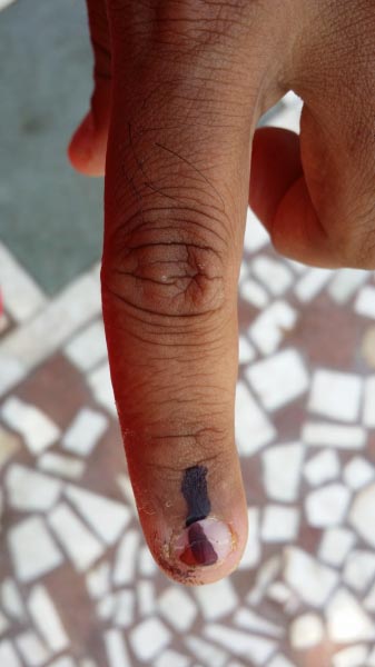 कुछ दाग अच्छे होते है…..