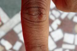 कुछ दाग अच्छे होते है…..