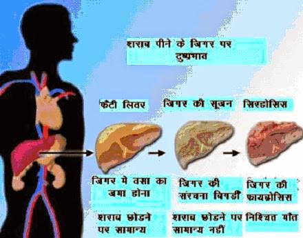 क्या आपको लत है शराब की ?