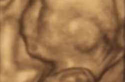 गर्भावस्था में मोबाइल फोन के प्रयोग से नवजात शिशुओं में हो सकतीं हैं व्यवहारगत समस्याएं और अतिक्रियाशीलता