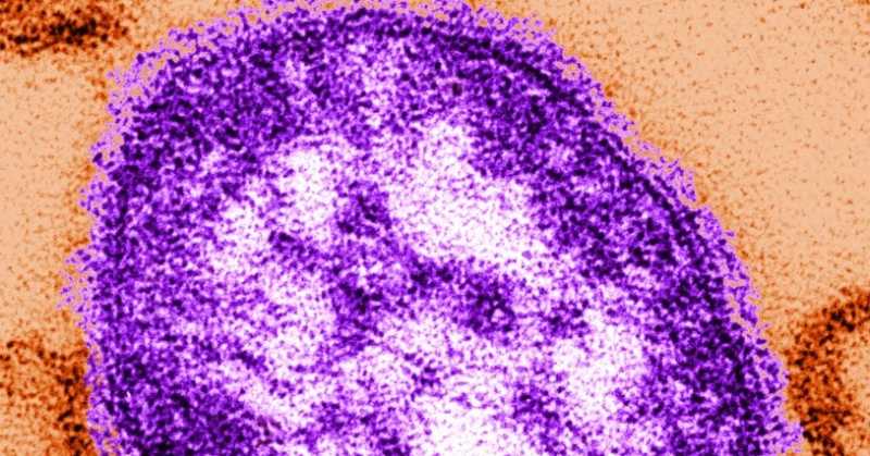 खसरे का खौफ 