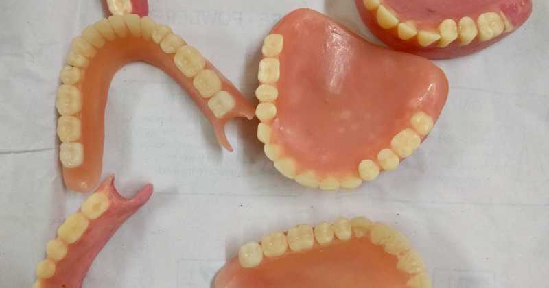 नकली दांतों के असली किस्से 