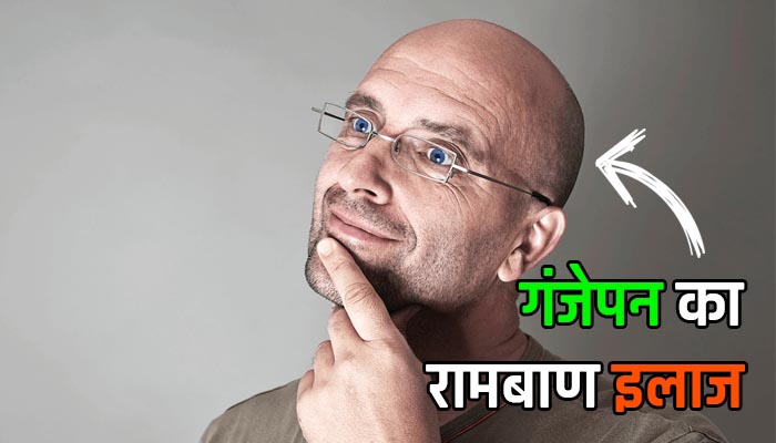 à¤à¤à¤à¥à¤ªà¤¨ à¤à¤¾ à¤°à¤¾à¤®à¤¬à¤¾à¤£ à¤à¤²à¤¾à¤ - à¤à¤à¤à¥ à¤¸à¤° à¤ªà¥ à¤¬à¤¾à¤² à¤à¤à¤¾à¤¨à¥ à¤à¥ à¤à¤ªà¤¾à¤¯