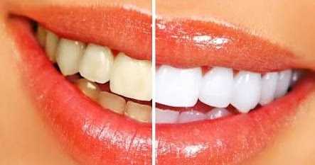 à¤¸à¤¿à¤°à¥à¤« à¤à¤ à¤¬à¤¾à¤° à¤à¤¸à¥à¤¤à¥à¤®à¤¾à¤² à¤¸à¥ à¤¦à¤¾à¤à¤¤ à¤à¤¾ à¤à¥à¥à¤¾ à¤à¤ªà¤¨à¥ à¤à¤ª à¤¬à¤¾à¤¹à¤° à¤¨à¤¿à¤à¤² à¤à¤à¤à¤¾ à¤à¤¸ à¤à¤®à¤¾à¤² à¤à¥ à¤¦à¤µà¤¾ à¤à¤° à¤¨à¥à¤¸à¥à¤à¥ à¤¸à¥