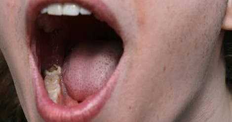 à¤¦à¤¾à¤à¤¤ à¤¦à¤°à¥à¤¦,à¤®à¤¸à¥à¤¡à¤¼à¥à¤ à¤®à¥à¤ à¤¸à¥à¤à¤¨,à¤®à¤¸à¥à¤¡à¤¼à¥à¤ à¤¸à¥ à¤à¥à¤¨ à¤¤à¥à¤°à¤à¤¤ à¤à¤¾à¤¯à¤¬ à¤à¤° à¤¦à¥à¤à¤¾ à¤¯à¥ à¤à¤®à¤¾à¤² à¤à¤¾ à¤à¤ªà¤¾à¤¯