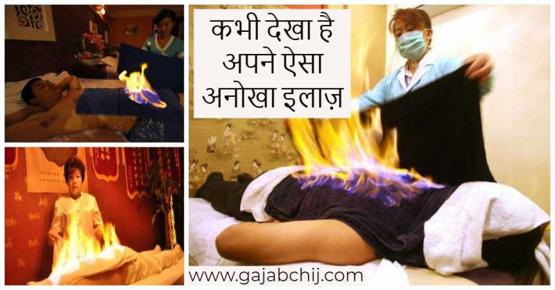 एक ऐसा इलाज जिसे देख कर आपकी रूह कांप जाएगी| - गजब चीज