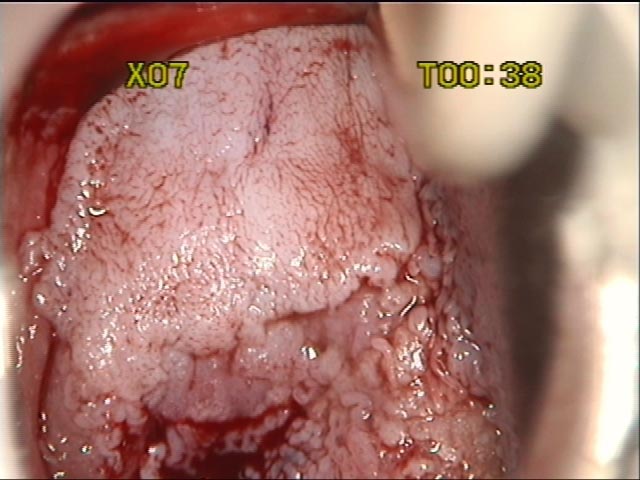 à¤¸à¤°à¥à¤µà¤¾à¤à¤à¤² à¤à¥à¤à¤¸à¤° - à¤à¥à¤ à¤¤à¤¥à¥à¤¯ #1
