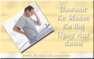 बवासीर के मस्से का इलाज की दवा और 10 उपाय - Bawasir In Hindi