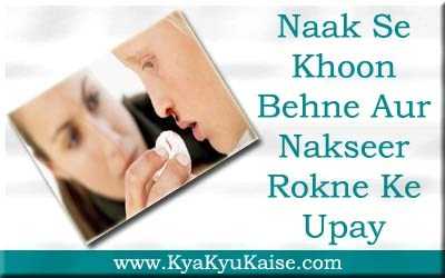नाक से खून बहने पर 10 आसान उपाय - Nakseer Ka Ilaj In Hindi