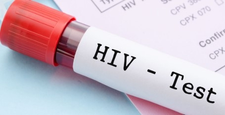 एचआईवी टेस्ट की कीमत प्रकार और प्रक्रिया: HIV Aids Test In Hindi