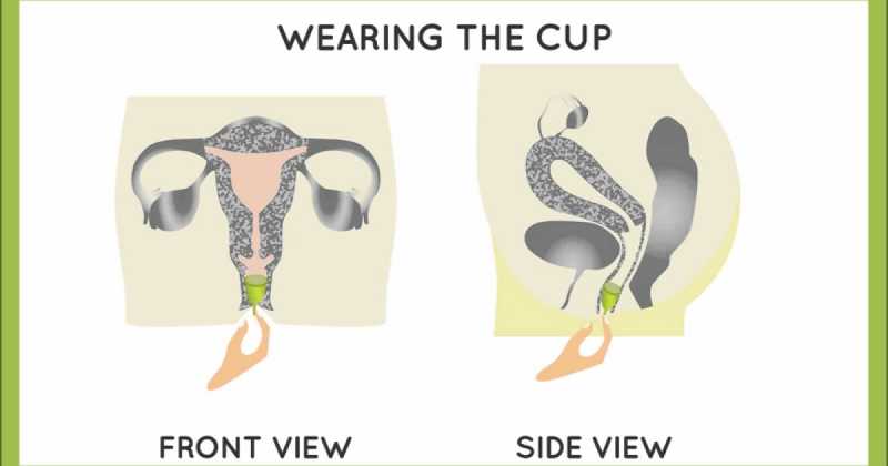 "Happy Periods" Aka Menstral Cup...!!!