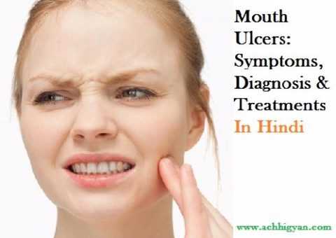 à¤®à¥à¤à¤¹ à¤à¥ à¤à¤¾à¤²à¥ à¤¦à¥à¤° à¤à¤°à¤¨à¥ à¤à¥ à¤à¤°à¥à¤²à¥ à¤à¤ªà¤¾à¤¯ | Muh Ke Chhale Kaise Thik Kare