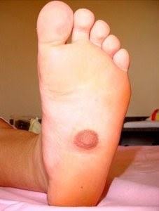 [OMG] Her Nipple Found On FOOT Not Tits !