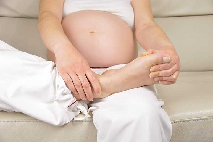 गर्भावस्था में हाथ-पैरों में सूजन (एडिमा) के कारण व उपाय | Pregnancy Me Sujan Aana