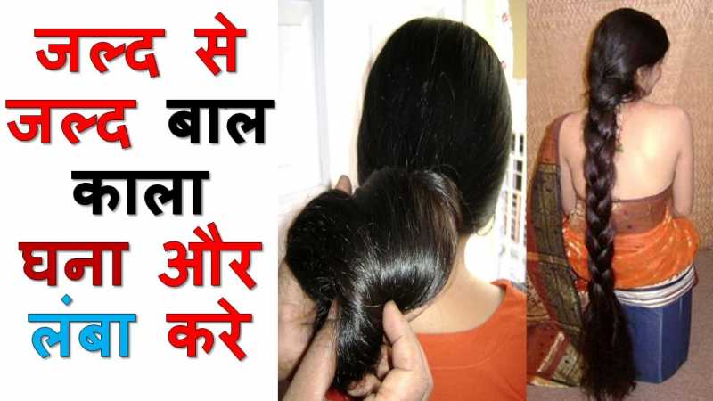 बाल बढ़ाने का तरीका और बाल बढ़ाने के उपाय हिंदी में Baal Badhane Ke Upay