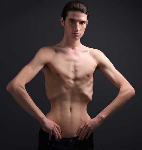 वजन बढ़ाने के तरीके घरेलु नुस्खे How To Gain Weight In Hindi  