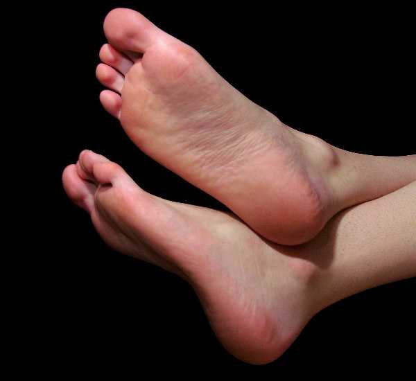 5 Amazing Natural Remedies To Cure Cracked Heels
