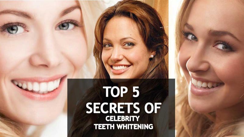 5 Secrets To Getting Whiter Teeth Like A Celebrity