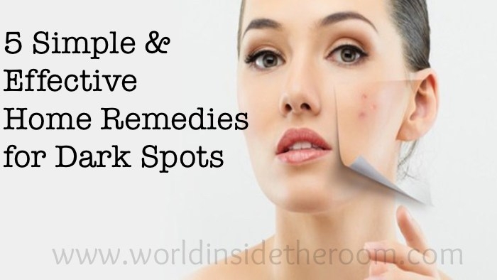 5 Simple & Effective Home Remedies For Dark Spots - WORLD INSIDE THE ROOM