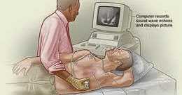 5 Tests To Diagnose Heart Diseases