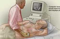 5 tests to diagnose heart diseases