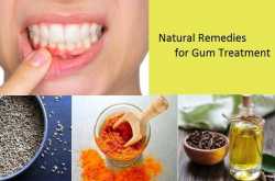 7 Home Remedies for Gum and Sensitive Teeth Problems
