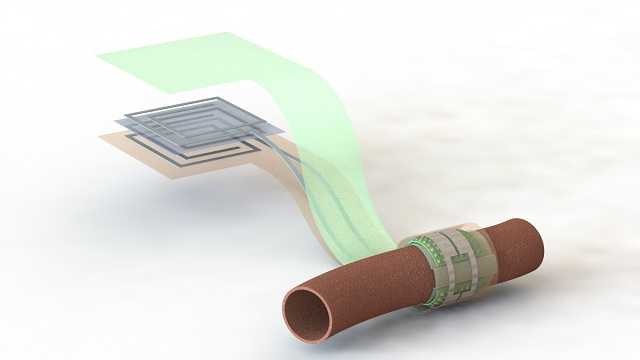 A Biodegradable Blood Flow Sensor That Self-Resorbs