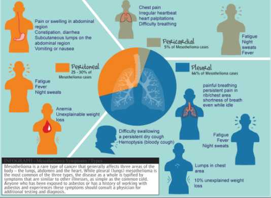 All Pericardial Mesothelioma Information FAQ