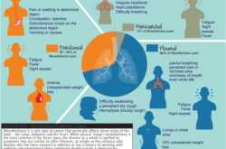 All Pericardial Mesothelioma Information FAQ