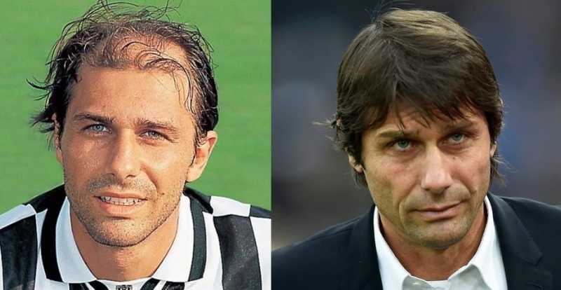 All You Want To Know About Antonio Conte