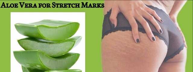 Aloe Vera For Stretch Marks - How To Use It Effectively? - Stylish Walks