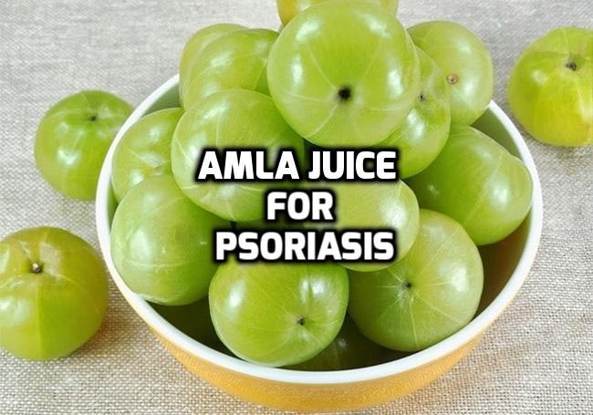 Amla (Indian Gooseberry) Juice For Psoriasis - Psoriasis Self Management