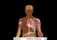 An Overview Of The Stem Cell Therapy