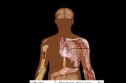 An Overview of the Stem Cell Therapy