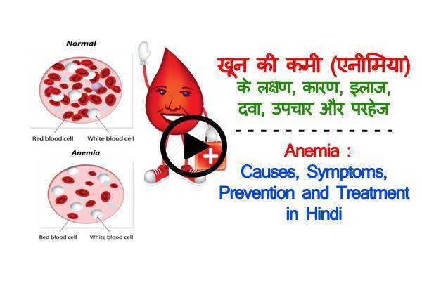 Anemia : Causes, Symptoms,Treatment In Hindi | खून की कमी का इलाज - Healthnuskhe.com