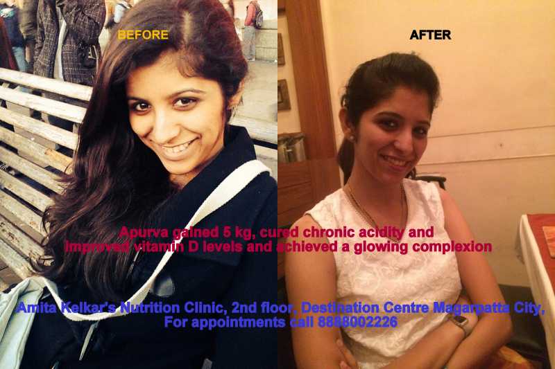 Apurva Gained 5 Kg In 3 Months And Cured Chronic Acidity And Poor Vitamin D Levels | My Client’s Success Story