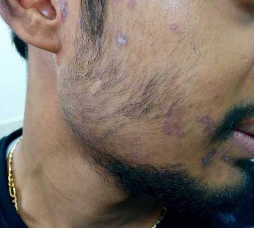 At Times Teeth Are Sacrificed Without Any Fault