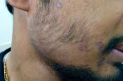 At Times Teeth Are Sacrificed Without Any Fault