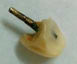 Avoid Going To Unqualified Chinese Dentists