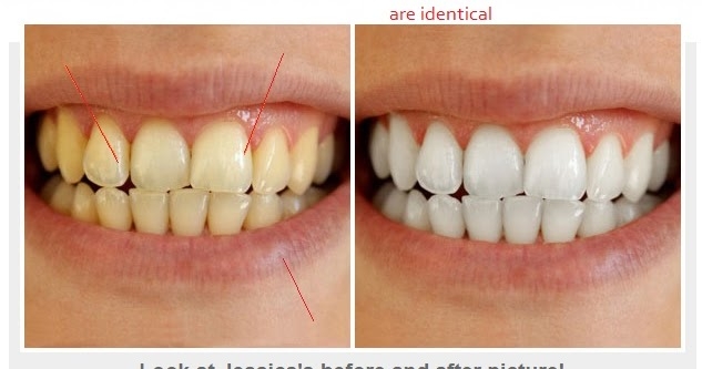 BHIM  Vis A Vis The Prepaid Cards