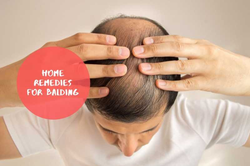 Baldness Treatment: Try These Home Remedies To Prevent Hair Problems