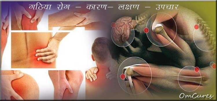 Best Treatment Of Gathiya | गठिया रोग के लक्षण - कारण और उपचार