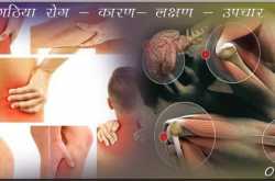 Best Treatment of Gathiya | गठिया रोग के लक्षण - कारण और उपचार