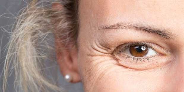 Best Wrinkles Prevention & Treatment Tips|Causes Of Wrinkles