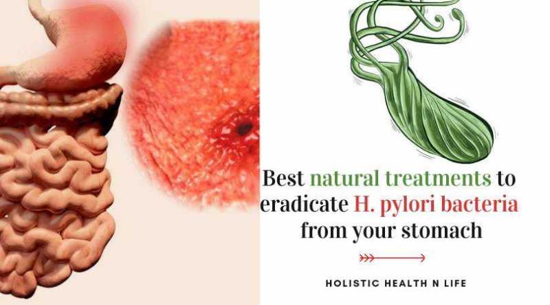 Best Natural Treatments To Eradicate H. Pylori Bacteria From Your Stomach