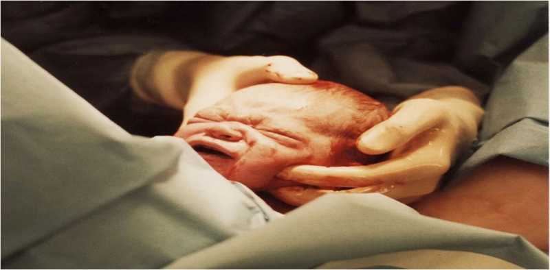 Birthing Options For Expecting Moms | Mom