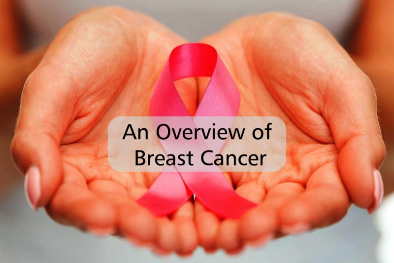 Breast Cancer 