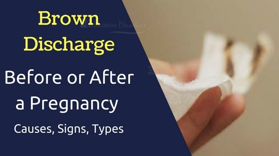 Brown Discharge Before Or After A Period- Reasons, Signs & Types