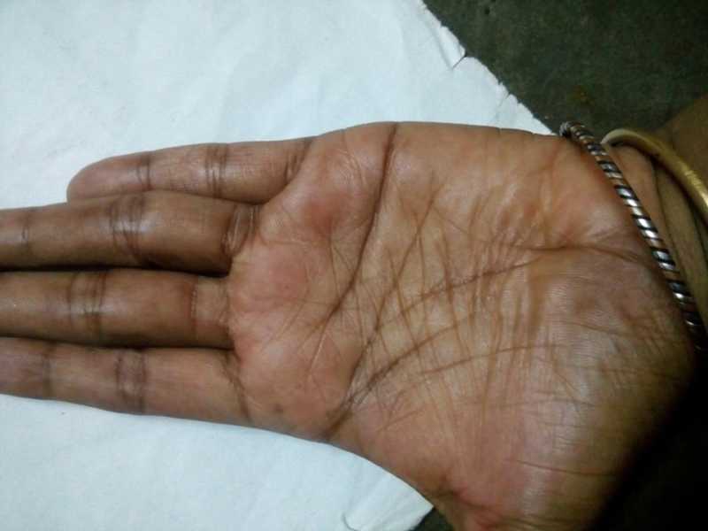 Can I Commint Sucide ? 