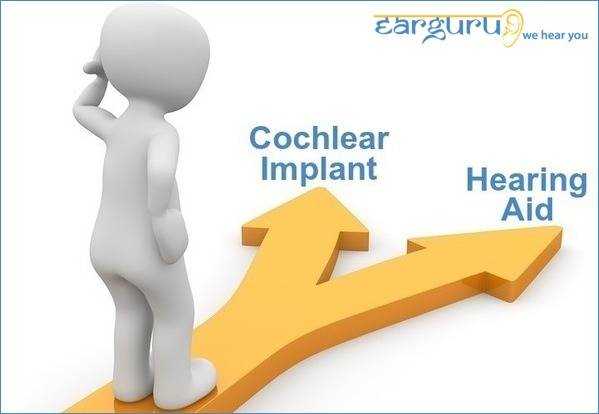 Cochlear Implant Vs Hearing Aids? Whatâs Best? - Earguru